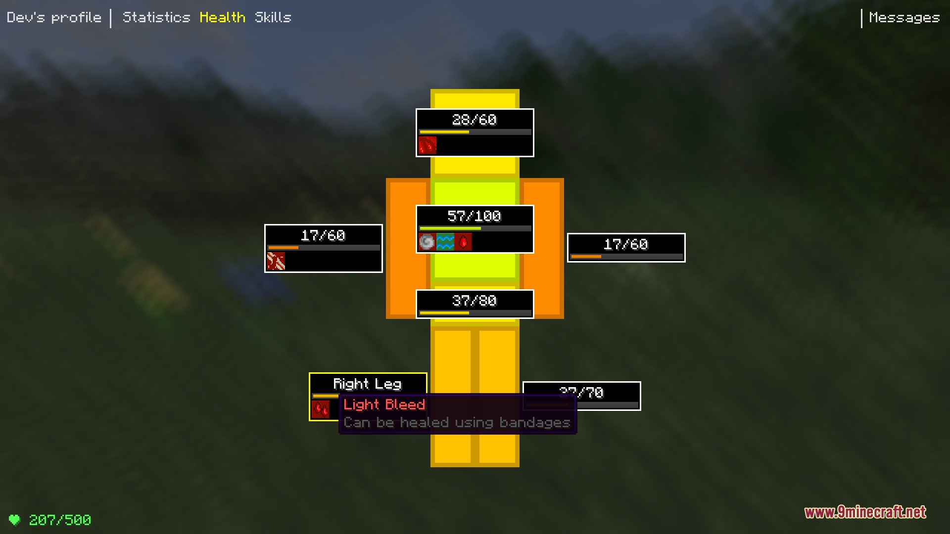 Medical System Mod Screenshot 2 Detailed Minecraft health screen showing numerical limb health and a light bleeding effect