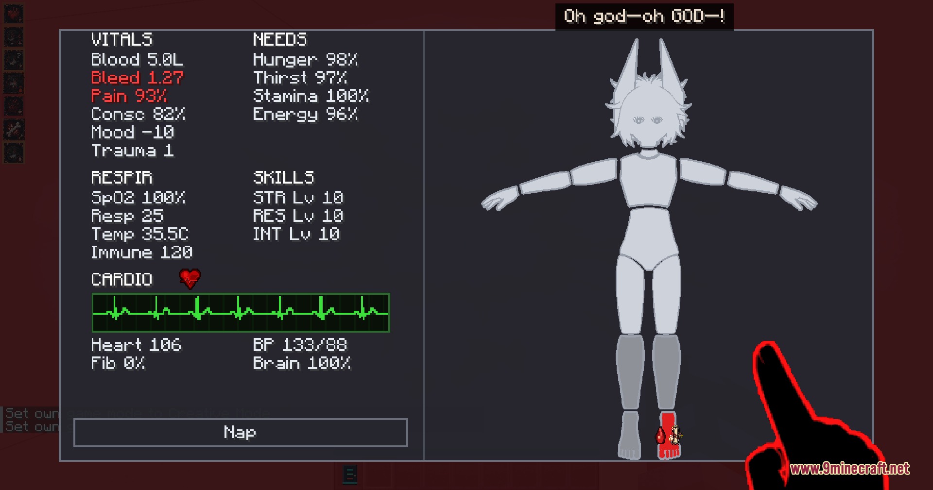 Vitals Under Siege Mod Screenshot 3 Medical interface displaying character vitals and a bleeding foot injury