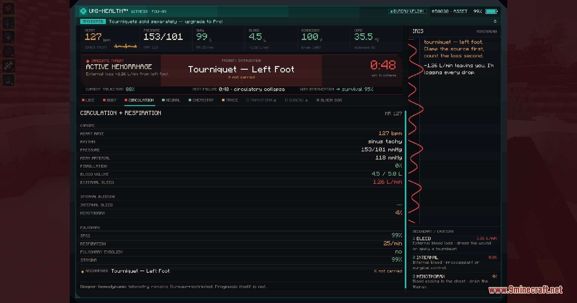 Vitals Under Siege Mod Screenshot 4 Detailed health monitor tracking active hemorrhage and vitals for injured player